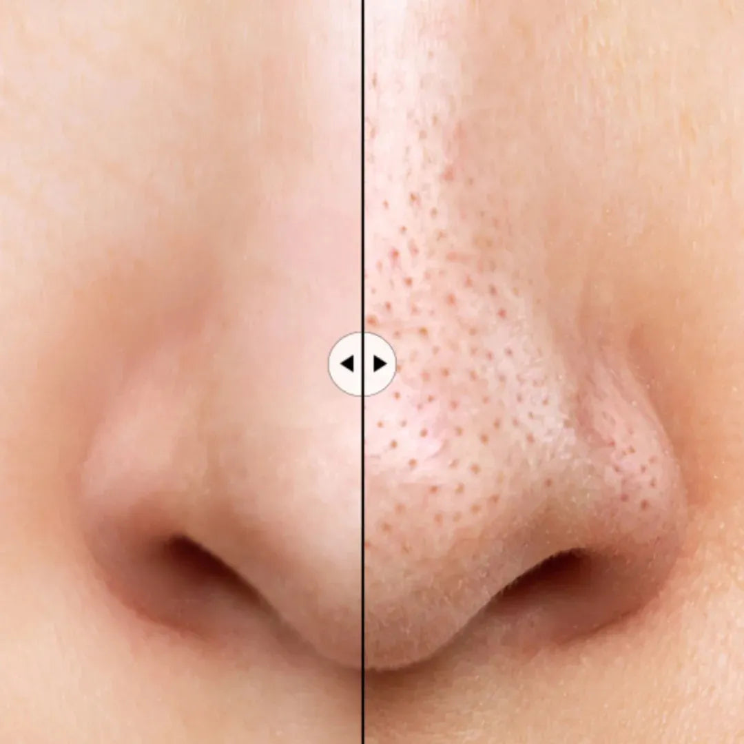 Ilso Super Melting Sebum Softener | Esencia para limpiar poros 150ml